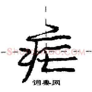 疟